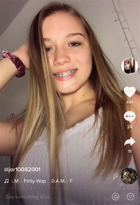 teens braces porn